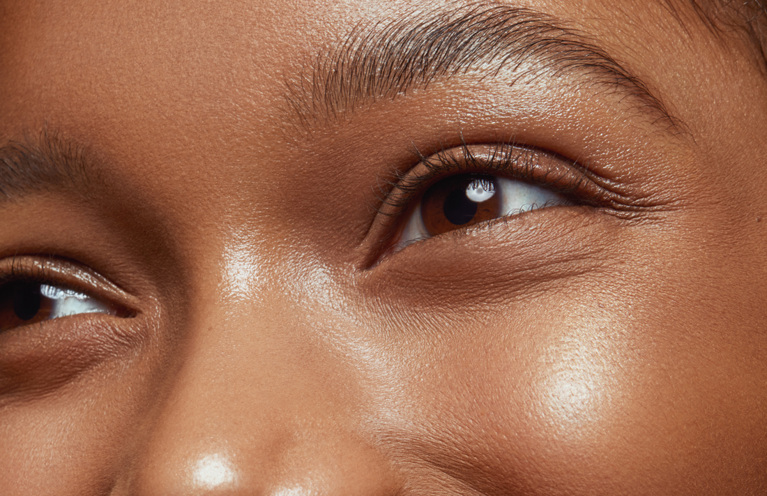 Here's How to Get Rid of Undereye Bags and Dark Circles to Look More Refreshed